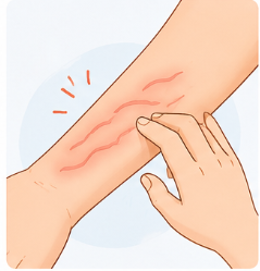 피부묘기증 ㅣ피부를 긁으면 부어오른다면?두드러기와 차이점 총정리