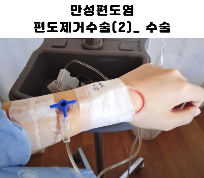 편도제거수술 -2일차 수술) 편도절제술 김해 서울이비인후과 만성편도염 유튜브편도왕 아데....