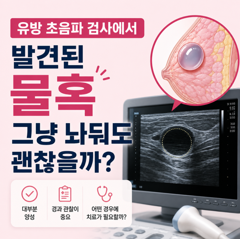 유방 초음파 검사에서 발견된 물혹, 그냥 놔둬도 괜찮은 '진짜' 이유