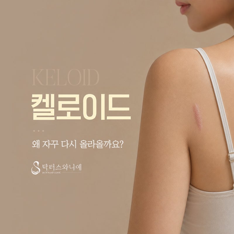 볼록하게 부풀어 오른 붉은 흉터, 켈로이드치료 방법은? 안양,범계,평촌 켈로이드주사