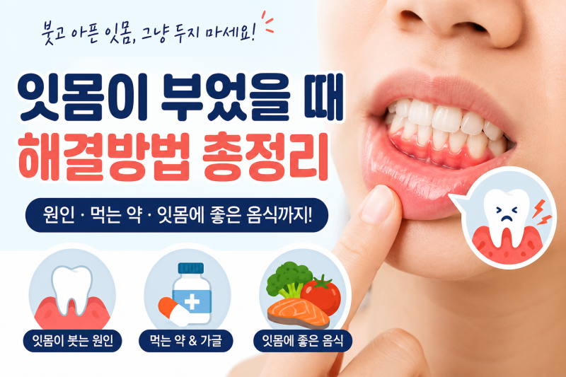 잇몸이 부었을 때 어떻게 해야 할까? 원인부터 약, 좋은 음식까지 총정리