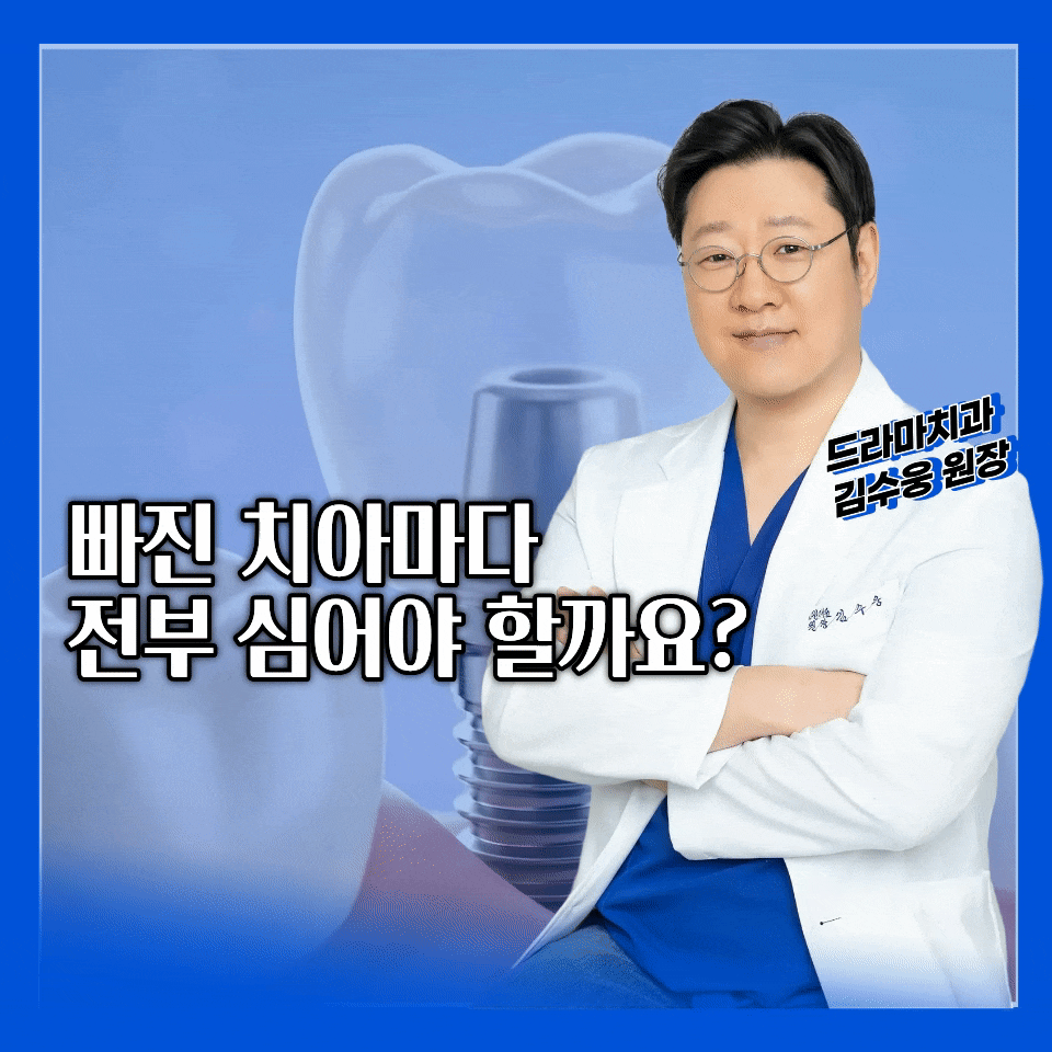 미금치과 임플란트, 치아 여러 개 없을 때 모두 심어야 할까요?