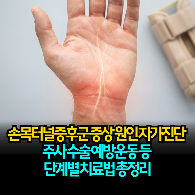 손목터널증후군 증상 원인 자가진단 병원 주사 수술 예방운동 등 단계별 치료법 총정리
