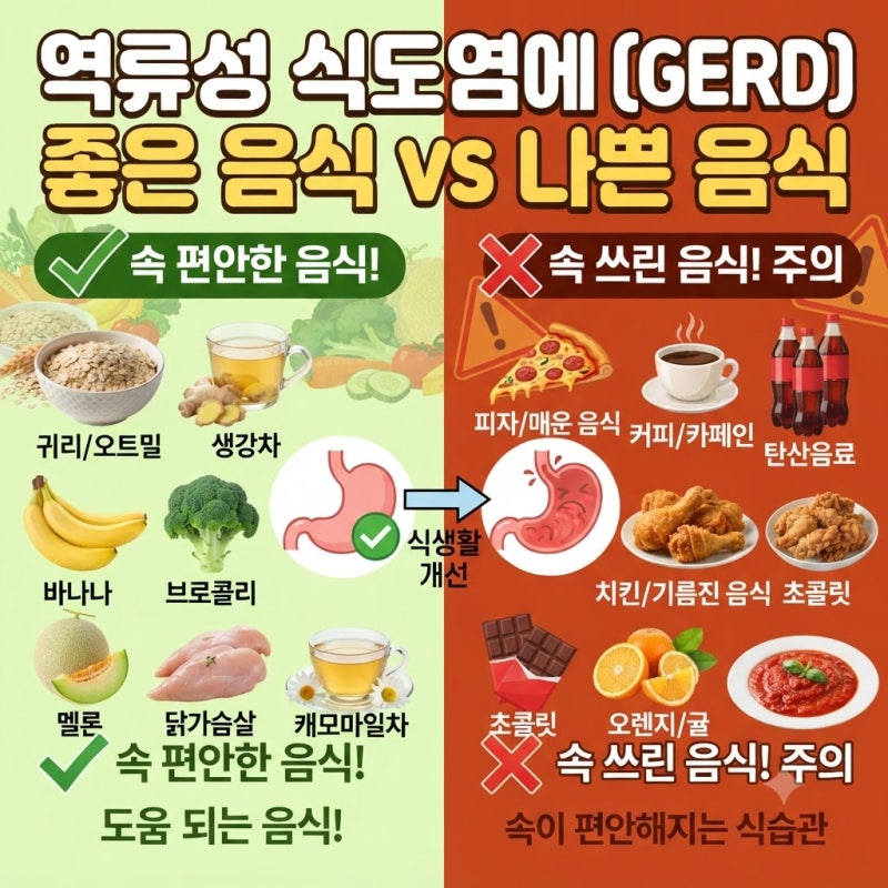 역류성식도염 음식 총정리 ③ 먹어도 되는 음식, 피해야 할 음식, 커피·우유·바나나까지