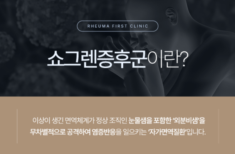 하남 내과 쇼그렌 증후군 치료법은?