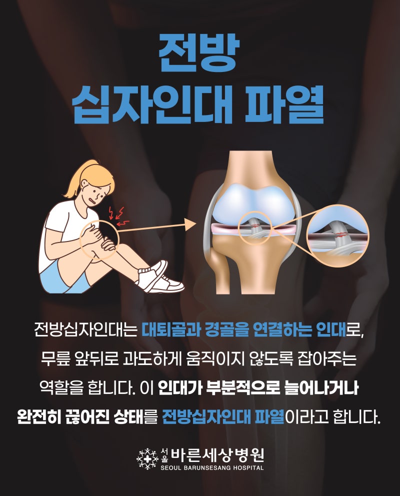 [질환] 전방십자인대 파열 초기증상, 무릎이 흔들린다면 치료가 필요할까요?