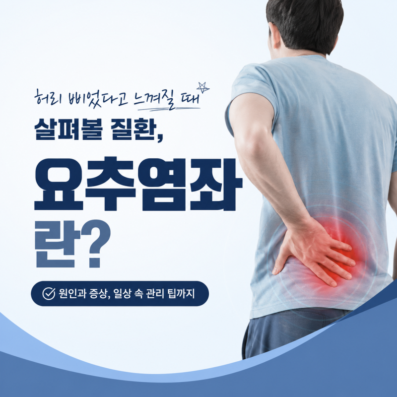허리 삐었다고 느껴질 때 살펴볼 질환, 요추염좌란?