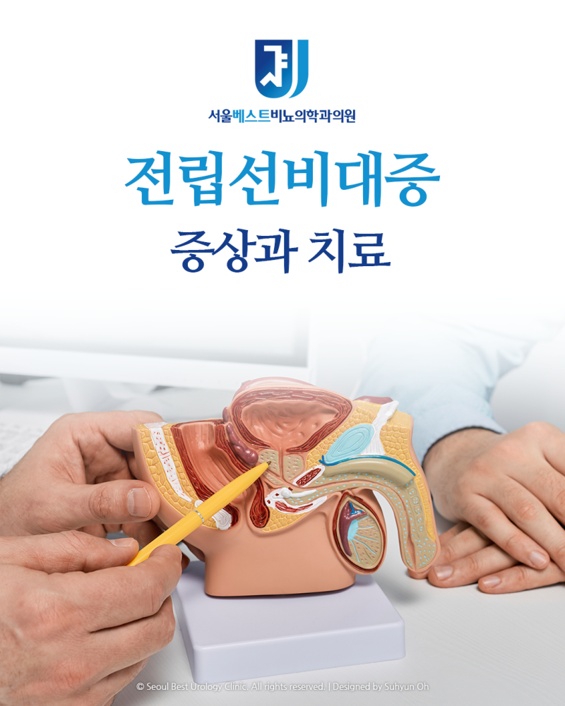 전립선비대증 치료, 약물치료부터 유로리프트·리줌·아쿠아블레이션·홀렙까지