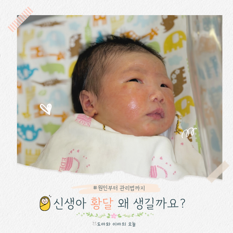 신생아 황달 원인부터 관리법