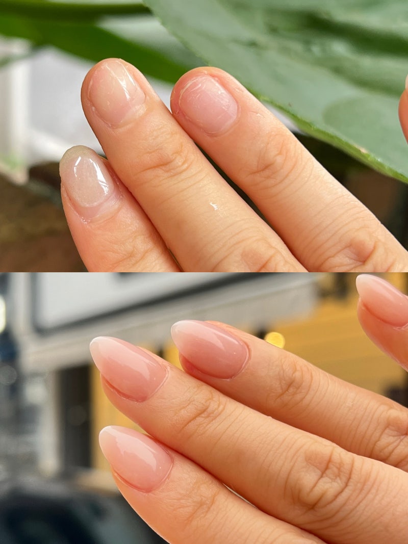 서울물어뜯는손톱 고민 끝! 물어뜯는손톱교정 전문 미미네일 후기