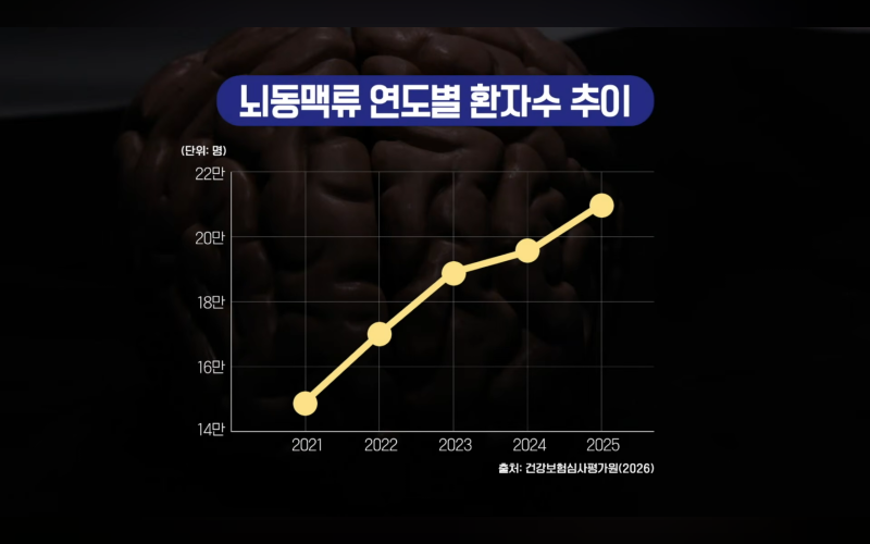 #명의 뇌동맥류, 40대부터 꼭 검사해야 하는 이유… 위험요인 총정리