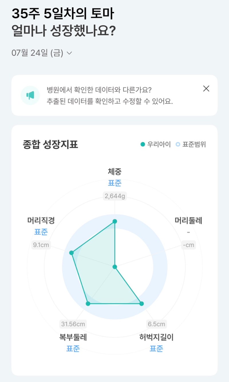 임신일기 33주-35주 • 다시 돌아온 임신 초기증상, 역류성식도염, 치골통, 자궁수축
