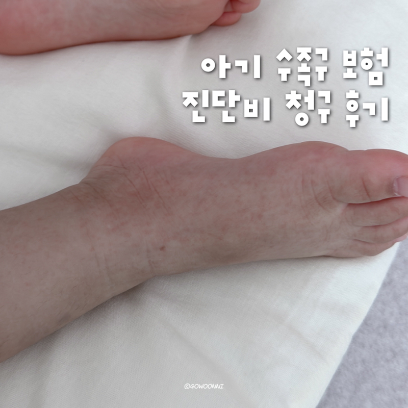 아기 수족구 보험 청구 서류 • 유의사항 ｜ 현대해상 30만원 진단비 지급받은 후기