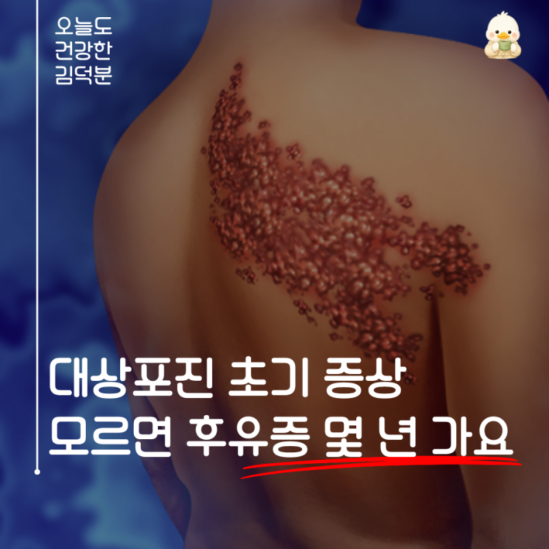 “발진보다 먼저 옵니다” 신경과 전문의가 말한 대상포진 초기 증상, 후유증 줄이는 골든타....