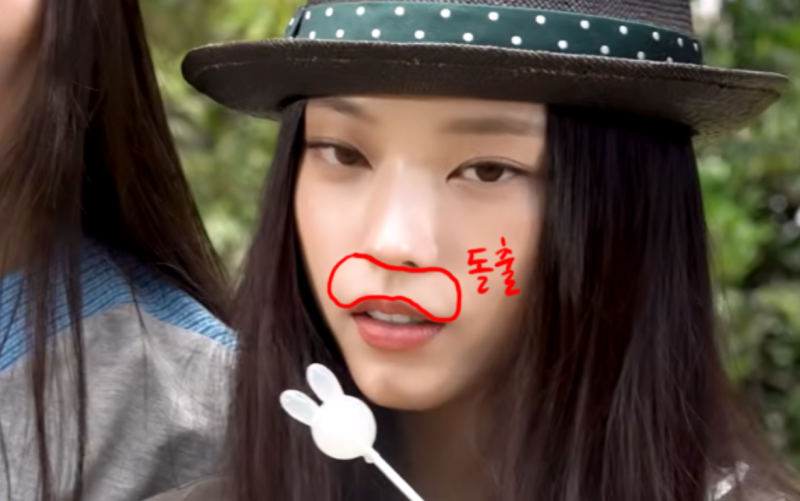 뉴진스 해린 치아성형으로 변한얼굴