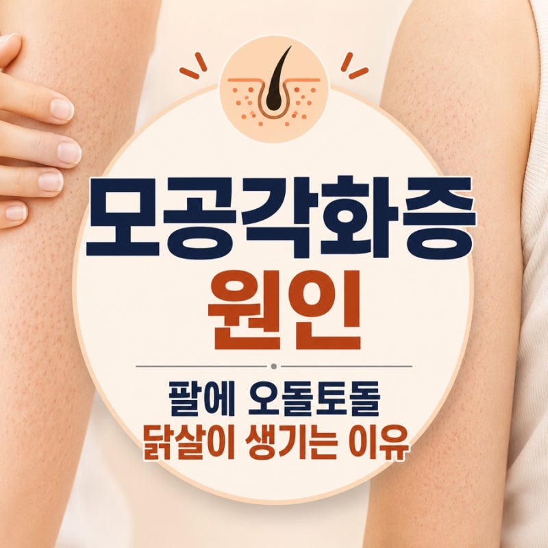 모공각화증 원인, 팔에 오돌토돌 닭살이 생기는 이유