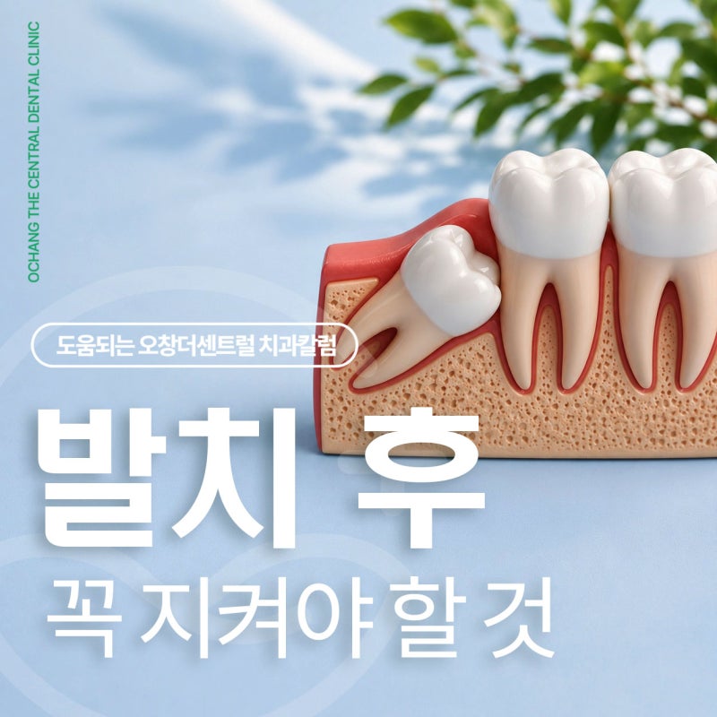 매복 사랑니 발치 후 식사, 매운 음식, 술 이렇게 하세요