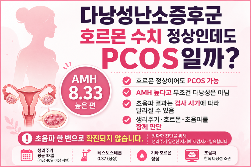 다낭성난소증후군 호르몬 수치 정상인데도 PCOS일까? AMH 8.33·초음파 결과 총정리
