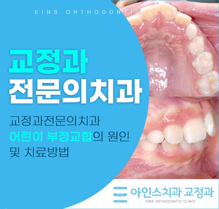 교정과전문의치과 어린이 부정교합의 원인 및 치료방법