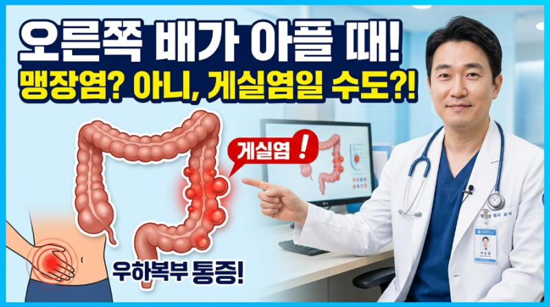 오른쪽 아래 배가 콕콕 쑤신다면? 맹장염인 줄 알았는데 '게실염'일 수 있습니다!
