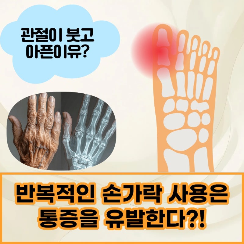 부산 금정구 손가락관절염에 좋은음식 치료를 대신할 수는 없습니다