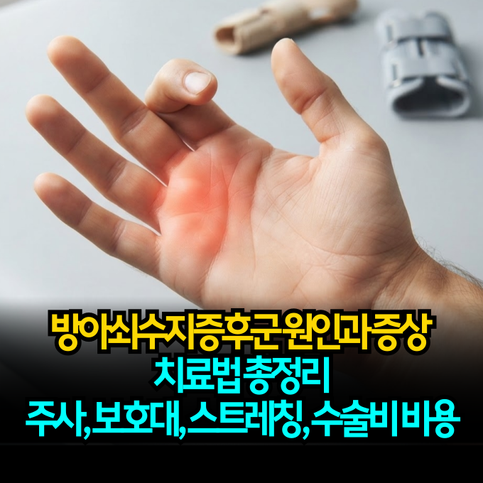 방아쇠수지증후군 원인과 증상 치료법 총정리 (+주사, 보호대, 스트레칭부터 수술비 비용까....