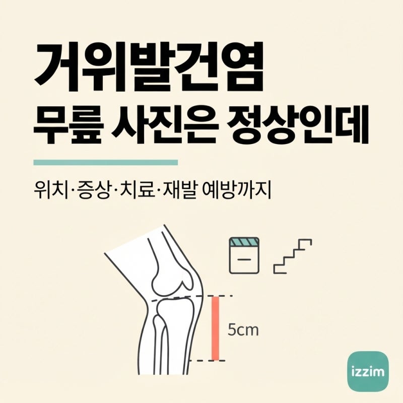 거위발건염, 무릎 안쪽이 계단 오를 때 아프다면 ｜ 위치·증상·X-ray가 정상인 이유·치료 총....