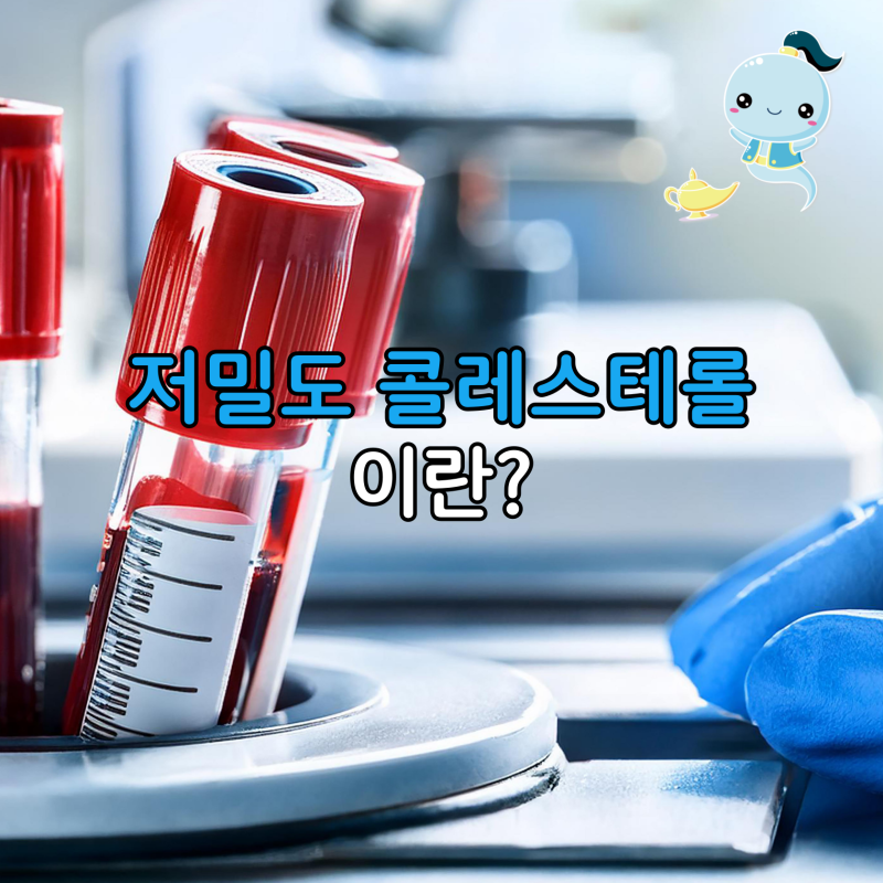 피검사 수치 보고 깜짝! 저밀도 콜레스테롤 높음 진단과 정밀 검사 후기