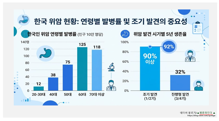 소화불량인 줄 알았는데 위암?" 생존율 90% 가르는 위암 초기 증상 4가지