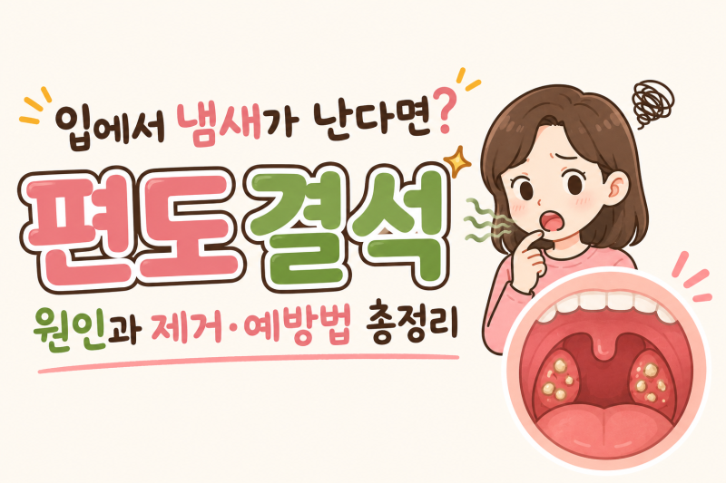 입에서 냄새가 난다면? 편도결석 원인과 제거·예방법 총정리