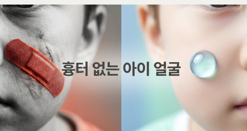 아기 얼굴 찰과상, 진물 날 때 흉터 연고 바르면 안 되는 이유 (콘투락투벡스 사용 시기)