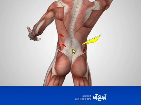 주말 급성염좌 병원가기 전까지 취할 수 있는 셀프치료｜응급처치 방법 (허리삐끗)