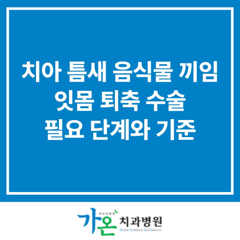 천안 치과에서 알려주는 치아 틈새 음식물 끼임과 잇몸 퇴축 수술 필요 단계와 기준