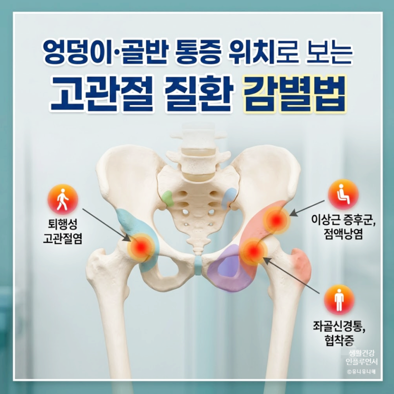 고관절 통증, 사타구니만 아픈 게 아닙니다! 위치별 고관절염 구별법