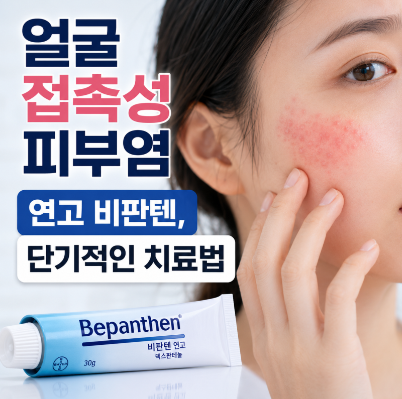 얼굴 접촉성 피부염 연고 비판텐 단기적인 치료법
