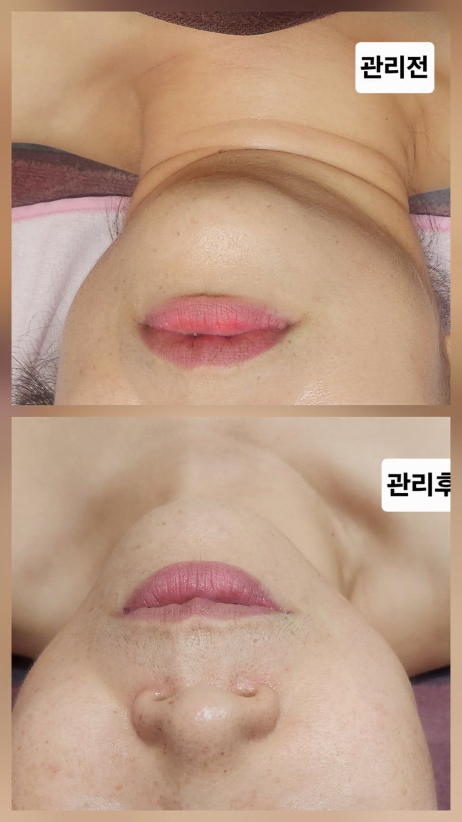 리프 사진 4