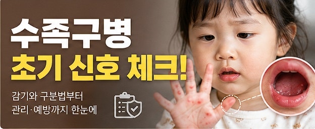 [2026 최신] 수족구 초기증상 감기와 구분하는 법과 가정 내 관리 수칙