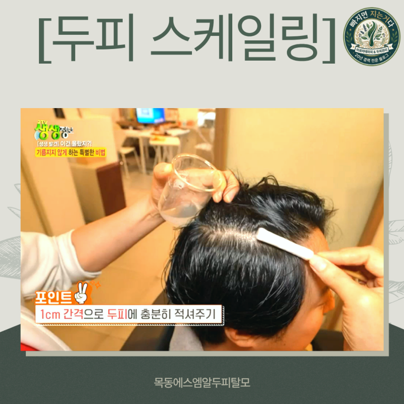두피 스케일링, 얼마나 자주 받아야 할까?[두피전문가 2026]