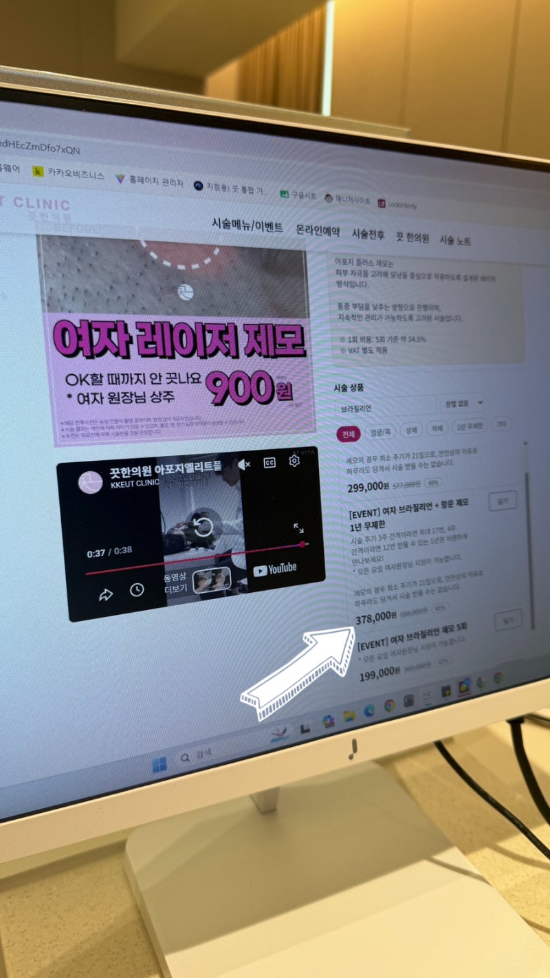 강남 레이저 제모 후기 | 브라질리언 5회 가격으로 1년 무제한 찾은 곳 (클라리티 제모기)