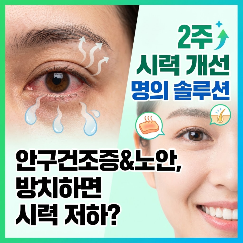 안구건조증 증상 치료를 위한 안약, 수술, 랜즈, 안대 등 효과적인 방법