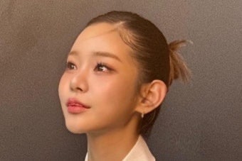맹승지 인중축소 수술 고백, 5년 고민 끝 선택…달라진 얼굴에 반응 폭발
