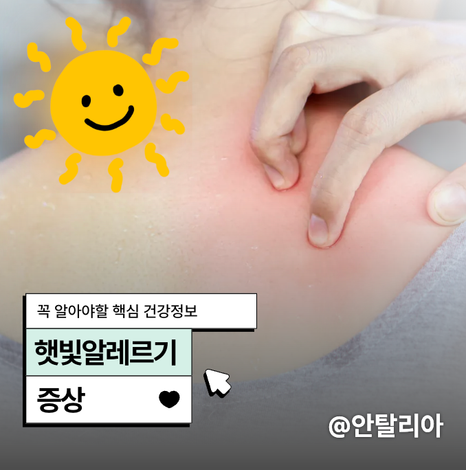 햇빛알레르기 증상 두드러기와 다른 차이는?