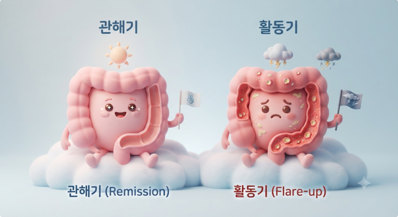 02. "완치가 없다고요?" 궤양성대장염과 평생 함께 가는 법 (관해기와 활동기의 정의)
