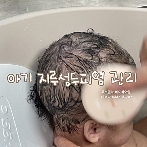 [육아용품] 아기 지루성두피염 이유, 관리 (무스텔라 베이비오일, 아토팜 뉴본 스칼프 로션)