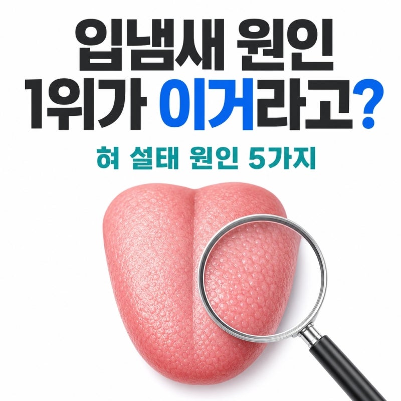 "입냄새 원인 1위가 이거라고?" 혀 설태 원인 5가지