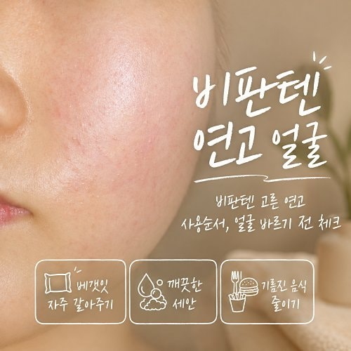 비판텐 연고 얼굴에 발라도 될까? 사용 순서와 주의점