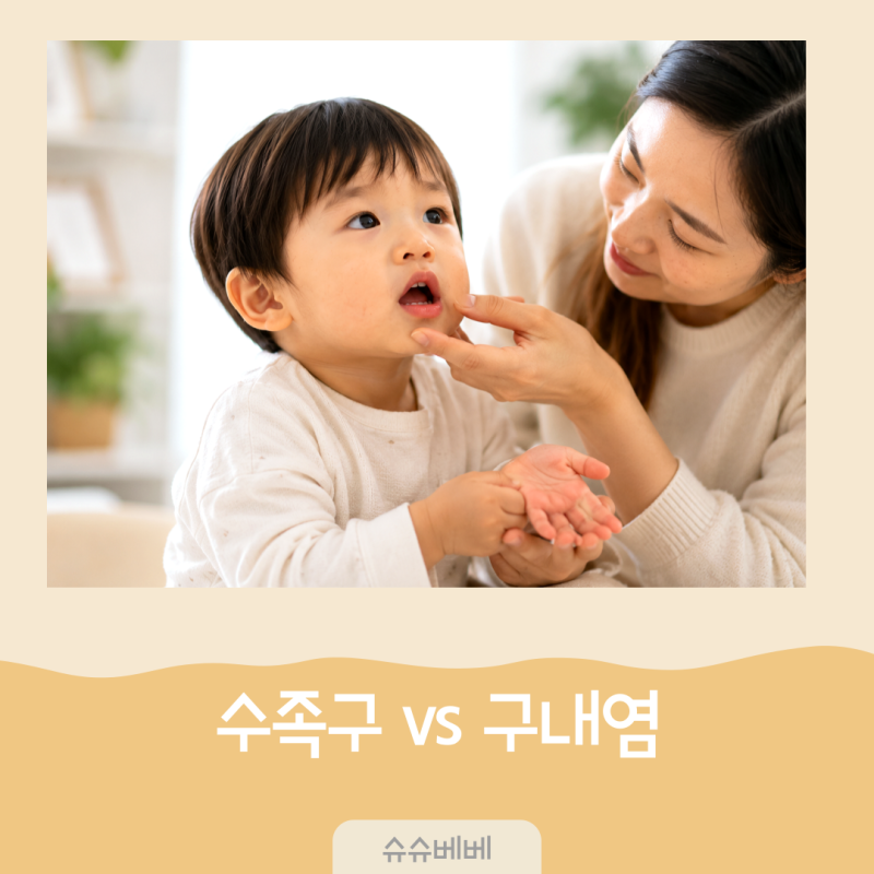 아기 수족구 증상 순서, 구내염과 차이점과 어린이집 등원 기준은?