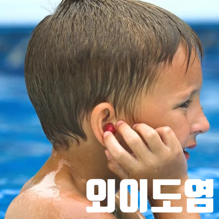 외이도염 증상 치료, 물놀이 후 귀 통증 가려움 진물, 점이액 넣는 방법