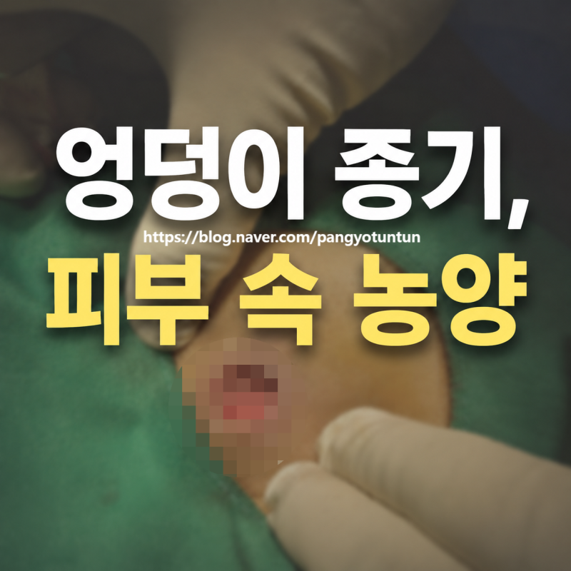 판교 엉덩이 종기, 피부 속 농양 치료 판교병원