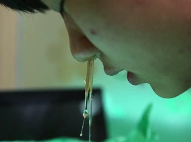 여름에 더 심해지는 축농증 치료 재발 예방법